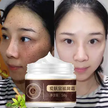 

Strong Effects Whitening Cream50g Remove Melasma Acne Spots Pigment Melanin Sunburn Pregnancy Spots Face Care Cream TSLM1