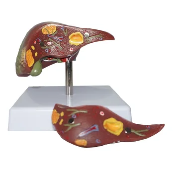 

Human Liver Structure Model Liver Disease Display