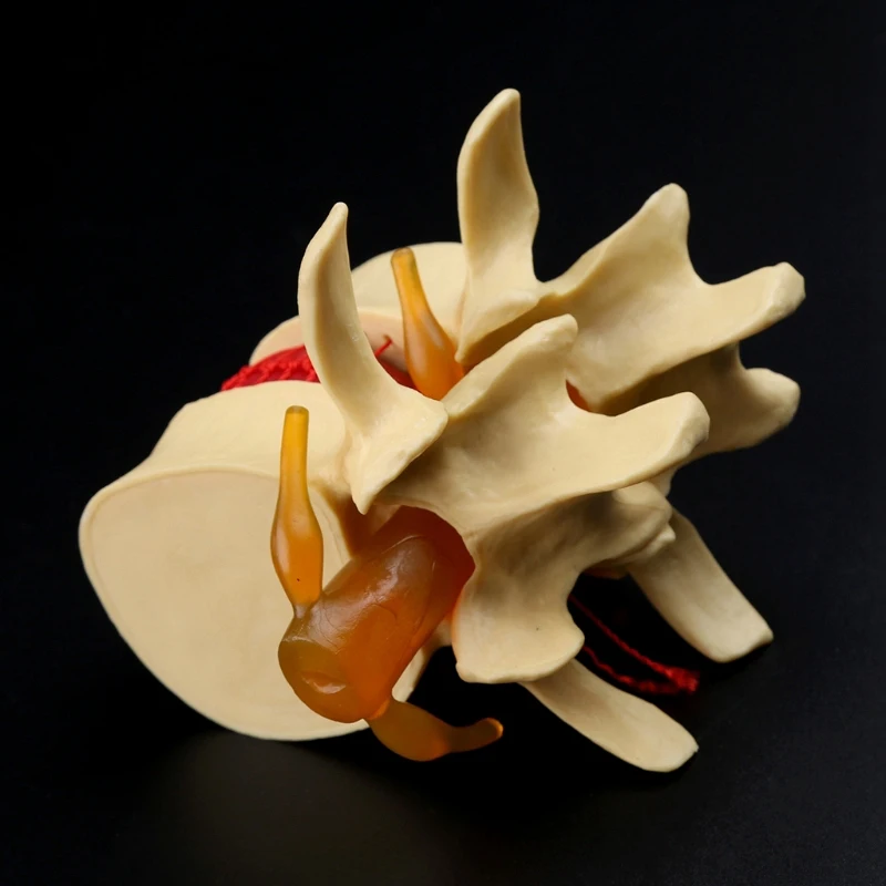 GTBL анатомическая спина поясница диск грыжа Анатомия медицинский обучающий инструмент