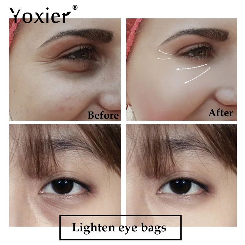Yoxier Snail Firming Eye Serum Eye Cream Anti Aging Anti Puffiness Fine Lines Dark Circle Moisturizing 1 Yoxier Snail Firming Eye Serum Eye Cream Anti Aging Anti Puffiness Fine Lines Dark Circle Moisturizing 2