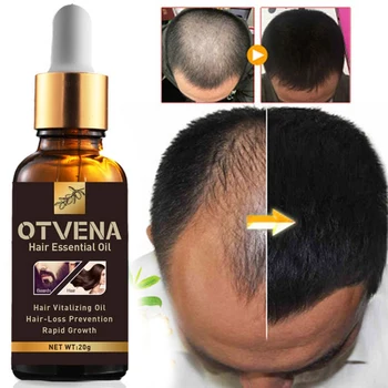 

Natural Herbal Hair Growth Oil Anti-hair Loss Hair Vitalizing Oil Moisturizing Hair Follicles Beard Oil Hair Loss Product