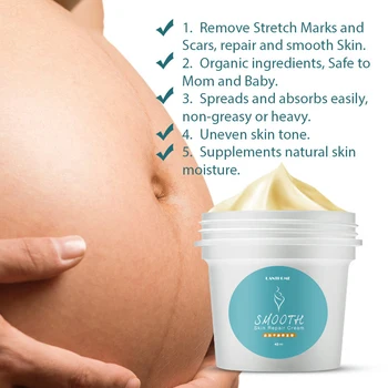 online Estrias Reparação Creme De Clareamento Clarear A Cor Da Pele Do Pigmento Estrias Removedor De Pele Nutritivo Creme De Maternidade