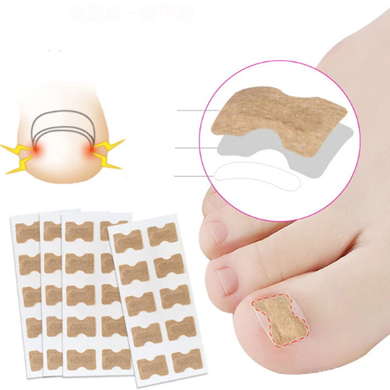 10Pcs/Set Ingrown Toenail Correction Patch Toenail Brace Pedicure Tool Double sided Tape Nail Repair|Nail Treatments| - AliExpress