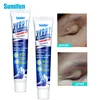 Sumifun 1/3Pcs Wart Removal Body Warts Treatment Cream Foot Care Cream Skin Tag Remover Foot Corn Removal Plantar Warts Ointment ► Photo 1/6