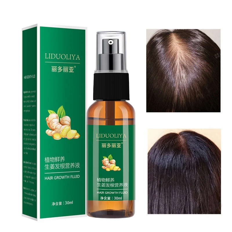Ginger Anti fork Hair Regrowth Treatment Product 30ml Hair Growth Solution Nourish Hair Scalp Hair Care 5