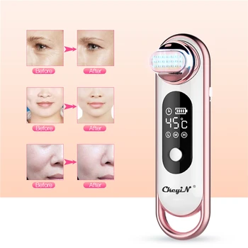 

Intelligent LCD Digital RF Beauty Machine Face Firming Tightening Wrinkle Remover Rejuvenation Anti-aging Vibtation Shrink Pore