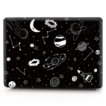 

D 14 D14 Case for Huawei Matebook 2020 Glitter Hard Clear Notebook Laptop Cover for Matebook D 15 D15 2019 2020 Case Coque Capa