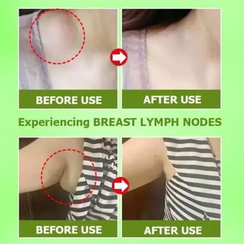 Patches Organic Lymphatic Drainage Detox Patch Anti-Swelling Patch Effective Painless Treatment Breast Lymph Nodes Patch