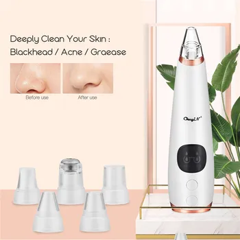 

6 In 1 Rechargeable Face Massager Blackhead Remover Face Deep Pore Cleaner Acne Pimple Removal Vacuum Suction Facial Massage