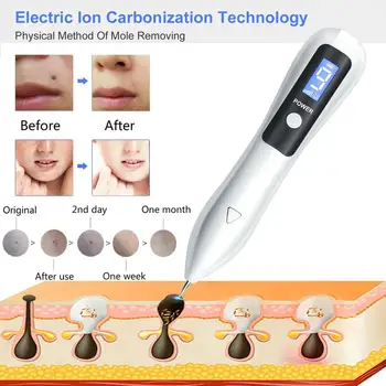 

MAUPIN Laser freckle remover beauty instrument remove black moles facial label tattoo remove spotlight spot mole sweeping pen