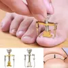 Ingrown Toenail Toe Fixer Recover Correction Device Pedicure Foot Nail Care Tool Straightening Clip Brace corrector Wire Fixer ► Photo 2/6