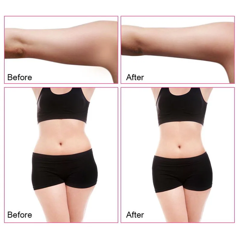 40KHz Multipolar 3 in 1 RF Body Slimming Skin tightenning Massager Machine For Lose Weight, Wrinkles Removal Beauty Device