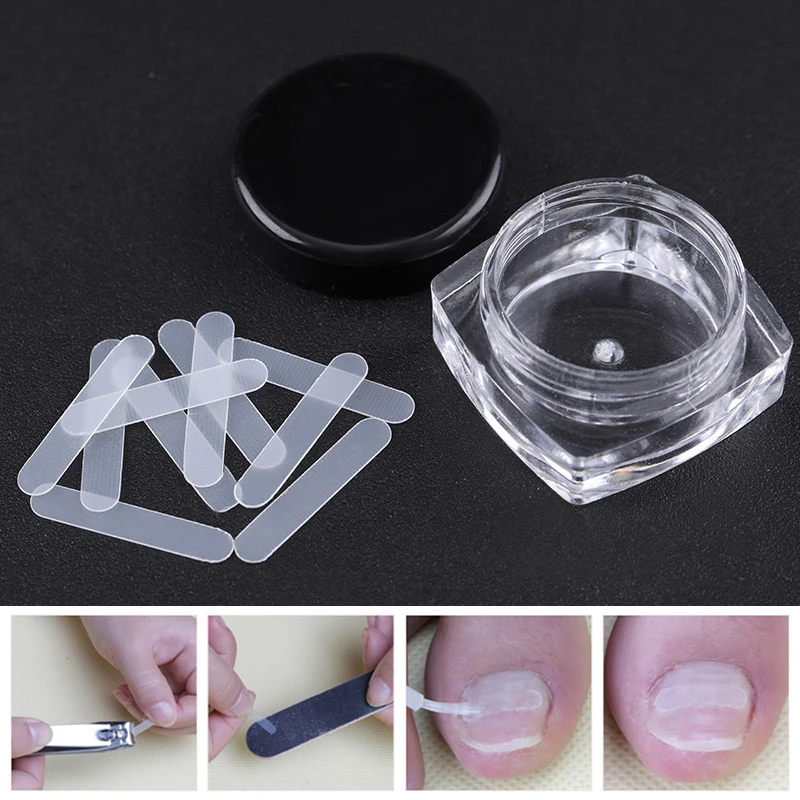 10pcs/Box Nail Ingrown Correction Toe Sticker Patch Fixed Foot Care Recover Correction Toenail File Corrector Pedicure Tools