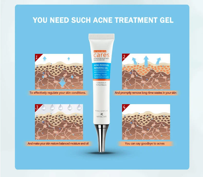 anti-acne_09