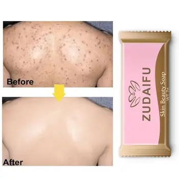 

7g Sulfur Soap Antibacterial Skin Cleaning Acne Psoriasis Bath Soap Anti-mite Removal Pimple Pore Acne Deep Cleaning Soap TSLM2