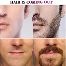 Новые Горячие Мужчины Борода фолликул ремонт Уход Эфирное масло тела волос бровей увлажняющий сглаживающий SMR88