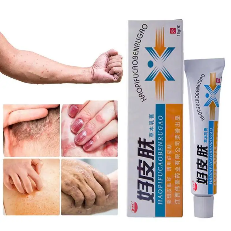 1PCS Skin Psoriasis Cream Dermatitis Eczematoid Eczema Ointment Treatment Care Skin Psoriasis Cream Cream Body Dropshipping O9X4