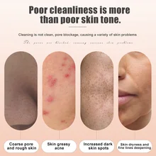 Лицевая маска для удаления черных точек Чистящая машинка Глубокая чистка пор, вакуумным отсосом, уход за кожей лица Уход за кожей Красота инструмент LDO99