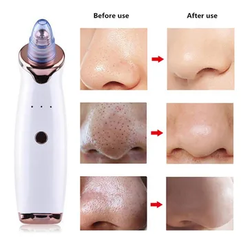 

Professional Electric Blackhead Remover Skin Care Pore Vacuum Acne Pimple Removal Vacuum Suction Tool Face Dermabrasion Machine
