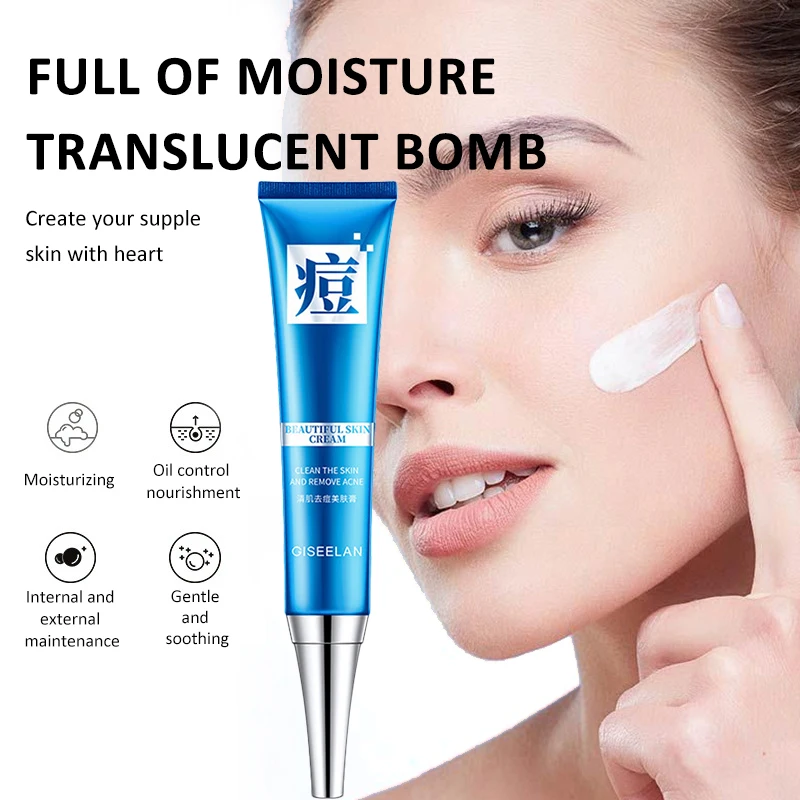 

Replenishing Acne Cream Face Care Moisturizing Repair Fade Acne Marks Refreshing Oil Control Deep Cleaning Skin Care TSLM2