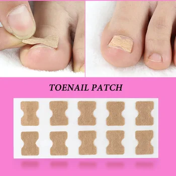 

Ingrown Toenail Corrector Sticker Paronychia Treatment Fixer Recover Corrector Pedicure Foot Toe Nail Care Tool Glue Free