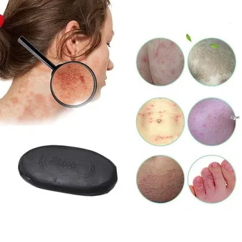 

Tourmaline Soap Black Bamboo Charcoal for Men and Women to Resist Black Spot and Remove Pox and Reduce Melanin Whitening Soap