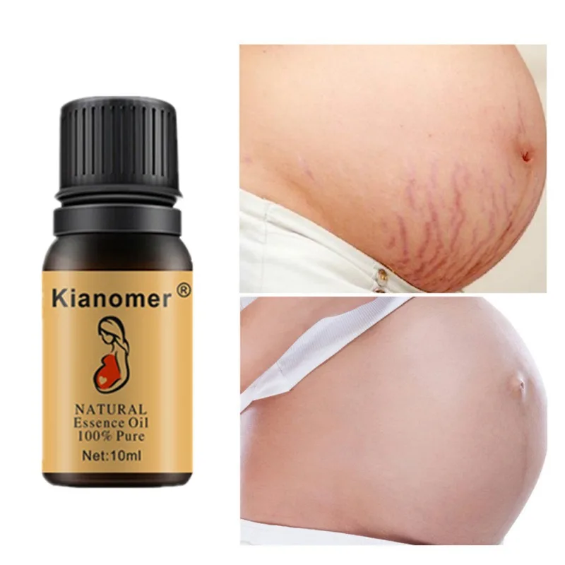 Stretch Marks Repair Essential Oil Nourishing Skin Lightening Pigment Stretch Marks Removal Oil