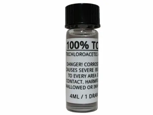 

Stretch Marks, Birthmarks, White Spots, Tattoos,Acne scars,Age spots 100% TCA Skin Peel Kit Removes Age Spots