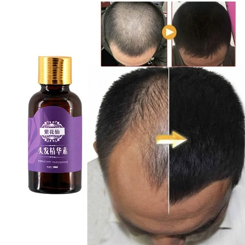 

3PCS Hair Loss Products Natural With No Side Effects Grow Hair Faster Regrowth Hair Growth Products