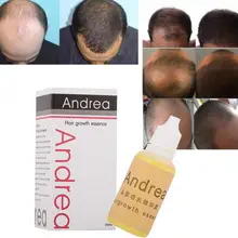 Andrea масло для роста волос, загуститель для роста волос, сыворотка против выпадения волос, продукт натуральный растительный экстракт, жидкость 20 мл