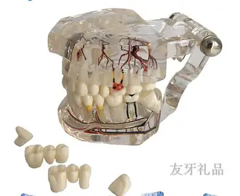 

transparent pathological implant nerve tooth model repair model oral teaching demonstration model