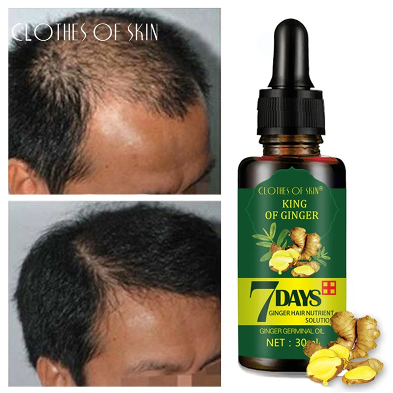 

7 Days Ginger Hair Growth Serum Germinal Hair Growth Essence Oil Hair Loss Treatement Growth Hair for Men Women CLOTHES OF SKIN