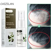 Cabelo crescimento spray soro eficaz produtos líquidos germinais couro cabeludo tratamentos evitar perda de cabelo desbaste cuidados de beleza para homens