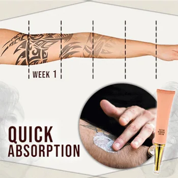 

Hot sale Tattoo Removal Cream Painless Remove Tattoo Ink Remover Without Scarring No Hurt Safe Gentle