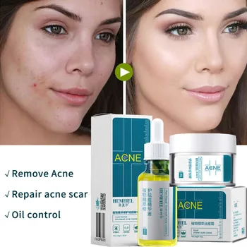 

HEMEIEL Herbal Acne Treatment Cream Oil control moisturizing Anti Acne Serum Shrink Pores Acne Scar Remove Face Care Whitening