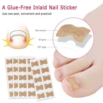 

Toenail Correction Tool Ingrown Toe Nail Treatment Elastic Patch Sticker Straightening Clip Brace Pedicure Tool