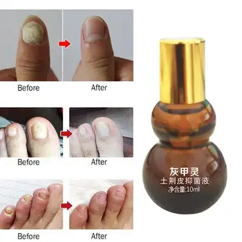

10ml Fungal Nail Repair Essence Serum Treatment Foot Onychomycosis Gel Infection Paronychia Nail Removal Fungus L8D8