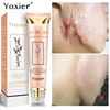 Yoxier Lavender Scar Repair Cream Acne Scar Removal Pigmentation Corrector Remove Stretch Marks Smooth Whitening Scar Skin Care
