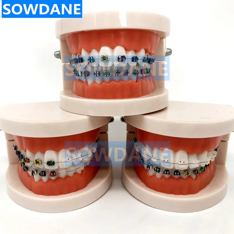 Dental Orthodontic Typodont Model With Ortho Metal Brackets Ceramic Bracket Arch Wire Buccal