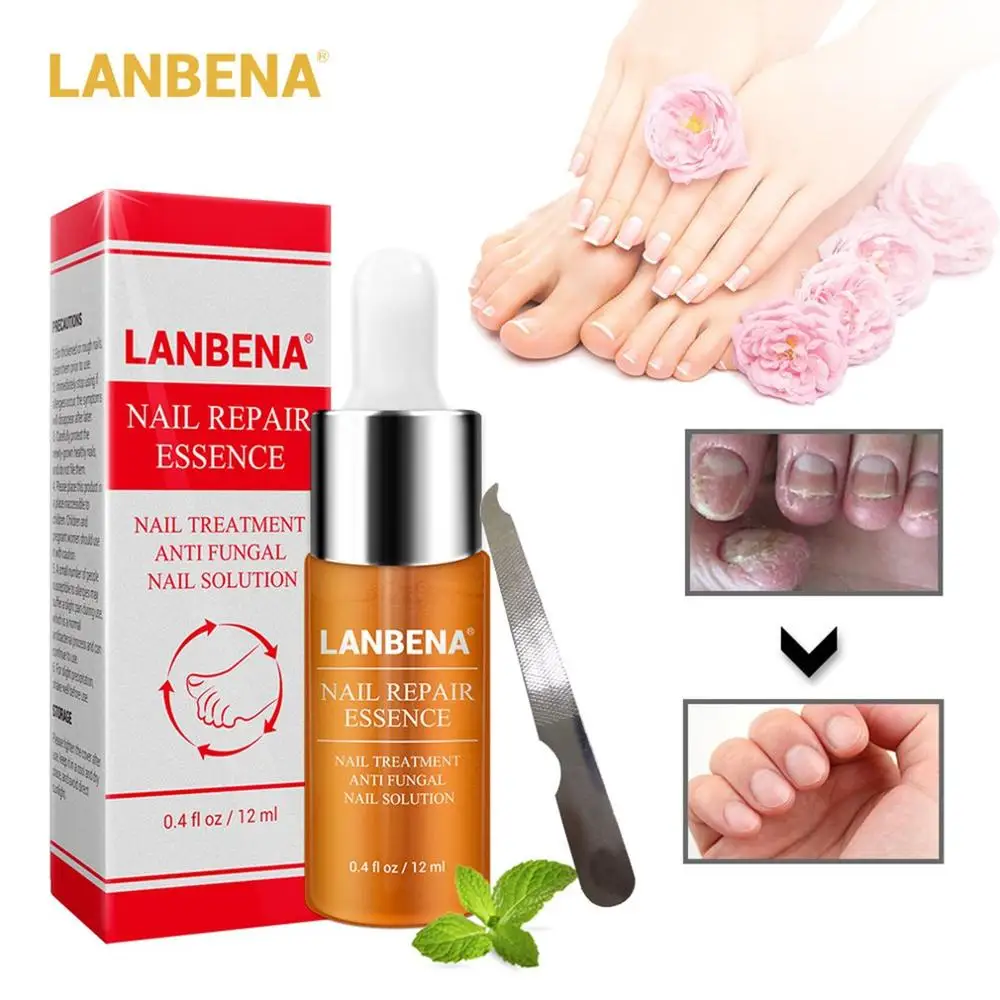 LANBENA, средство для восстановления ногтей, сыворотка, Лечение грибка, удаление ногтей, онихомикоз, ноготь, свечение, питательный уход за руками и ногами