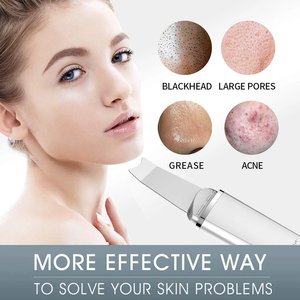 SPA Skin Scrubber Facial Scrubber Electric Gentle Blackhead Remover Ultrasonic Facial Cleaner Spatula Face Lifting Massager