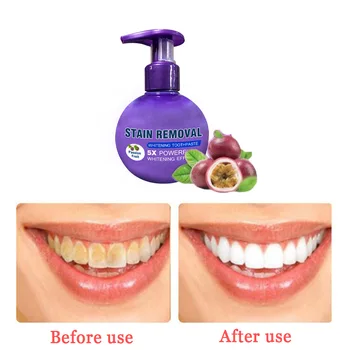 

1Pcs Press Toothpaste Stain Removal Whitening Toothpaste Stain Remover Oral Hygiene Care Baking Soda Teeth Cleanning