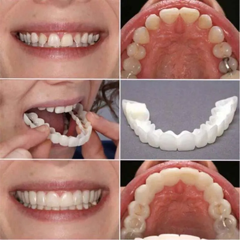 

2Pcs/Set Silicone Teeth Whitening Teeth Cover Teeth Braces Simulation Denture Upper Lower Teeth Set with Box Orthodontic Braces