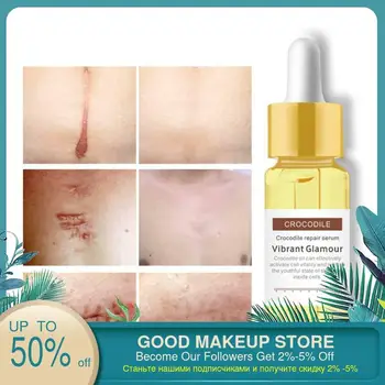 

VIBRANT GLAMOUR Crocodile Repair Scar Face Serum Removal Acne Scar Whitening For Spots Acne Treatment Stretch Marks Skin Care
