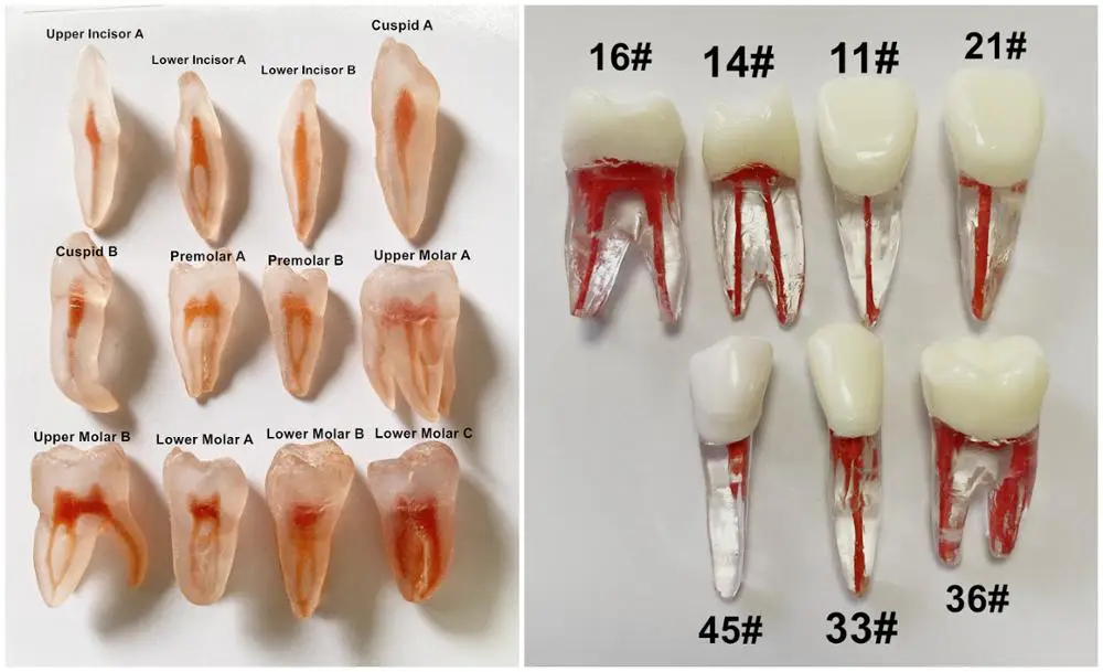 Model Gigi Gigi Endo File Jalur Berlatih Saluran Akar Gigi Atas Bawah