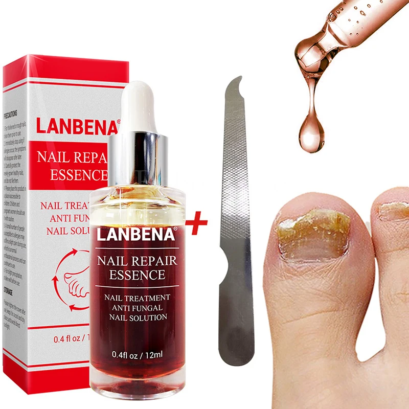 Эссенция Lanbena для восстановления ногтей средство от грибка лечение Lambena Antihongos на