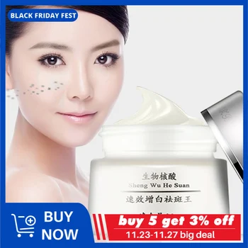 

Strong Effects Powerful Whitening Freckle Cream 25g Remove Melasma Acne Spots Pigment Melanin Dark Spots Face Care Cream
