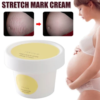 

Stretch Mark Cream Scar Cream Repair Anti-Aging Anti-Winkles Firming Body Creams for Pregnancy SDFA88