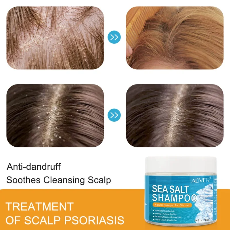 Natural Sea Salt Shampoo Hair Treatment Shampoo For Scalp Psoriasis Itching Scalp And Dandruff Shampoos Aliexpress