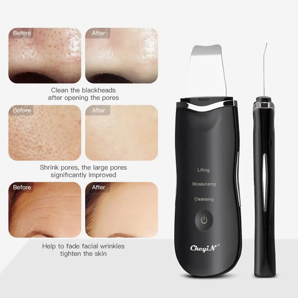  Ultrasonic Face Cleaning Skin Scrubber Facial Cleansing Peeling Machine Pore Cleaner + RF EMS LED A - 4000142912202